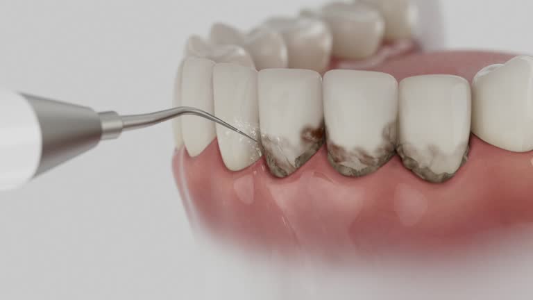 Trusted Teeth Cleaning And Checkup service in Donna, TX - Dentist Open Now
